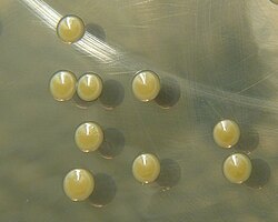 S. aureus on trypticase soy agar: The strain is producing a yellow pigment staphyloxanthin.