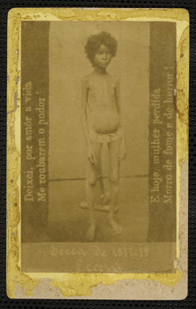 Malnourished child during Brazil's 1877–78 Grande Seca (Great Drought).