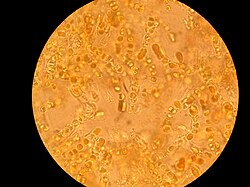 The photosynthetic cyanobacterium Hyella caespitosa (round shapes) with fungal hyphae (translucent threads) in the lichen Pyrenocollema halodytes