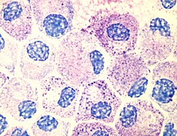 Photo of cultured mast cells at 100× stained with Tol Blue