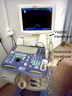 Photograph of transvaginal ultrasound machine