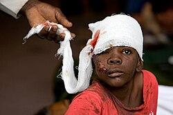 A Haitian boy receives treatment at a MINUSTAH logistics base.