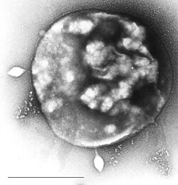 Sulfolobus infected with the DNA virus STSV1.[165] Bar is 1 micrometer.