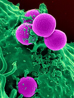 Scanning electron micrograph of a human neutrophil ingesting methicillin-resistant Staphylococcus aureus (MRSA)