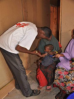 An MSF health worker examines a malnourished child in Ethiopia, July 2011.