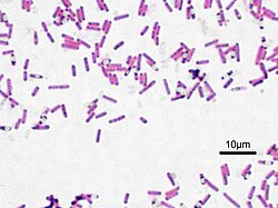 Gram-stained B. subtilis