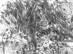 Transmission electron micrograph of decalcified woven bone matrix displaying characteristic irregular orientation of collagen fibers
