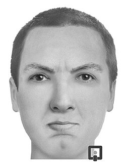 Bilateral features in the face and body, such as left and right eyes, ears, lips, wrists and thighs, often show some extent of fluctuating asymmetry. Some individuals show greater asymmetry than others.