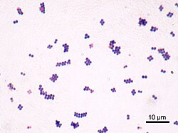 Gram stain of S. aureus cells, which typically occur in clusters: The cell wall readily absorbs the crystal violet stain.