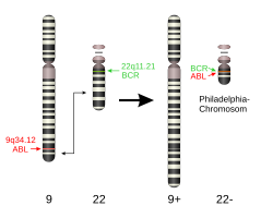 T(9,22) translocation