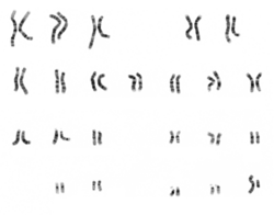 Micrographic karyogram of human male using Giemsa staining