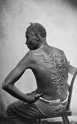 Peter, formerly enslaved on a cotton plantation along the Atchafalaya River, photo taken at Baton Rouge, Louisiana, 1863; after the whipping, Peter's wounds were salted, a common practice;[191][192] the overseer who whipped Peter was fired by slave owner Capt. John Lyons[193] (original carte de visite by McPherson & Oliver)
