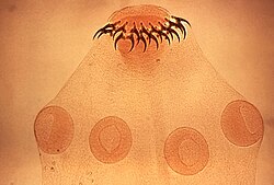 Head (scolex) of tapeworm Taenia solium, an intestinal parasite, has hooks and suckers to attach to its host