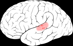 The primary auditory cortex is one of the main areas associated with superior pitch resolution.