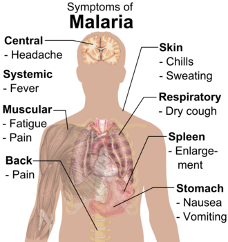 Main symptoms of malaria[24]