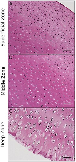 Histology of articular cartilage zones.[5]