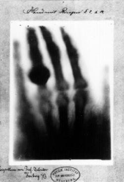 Hand mit Ringen: print of Wilhelm Conrad Röntgen's first "medical" x-ray, of his wife's hand, taken on 22 December 1895 and presented to Professor Ludwig Zehnder of the Physik Institut, University of Freiburg, on 1 January 1896