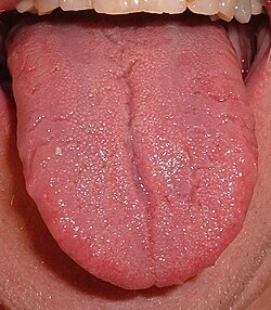 The lingual septum can be seen running vertically through the center of the tongue.