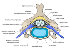 Cervical vertebra with intervertebral disc