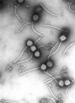Gamma phage, an example of virus particles (visualised by electron microscopy)