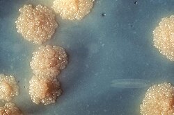 A close-up of Mycobacterium tuberculosis in a culture medium