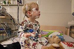 Young boy at the St. Louis Children's Hospital
