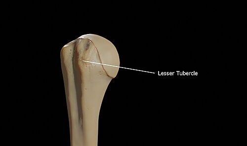 Lesser tubercle of the right humerus
