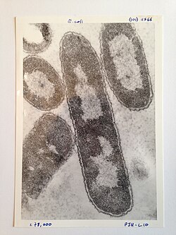 An image of E. coli using early electron microscopy