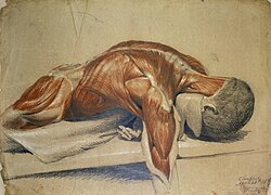 A dissected body, lying prone on a table, by Charles Landseer