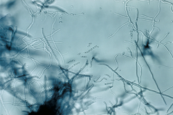 Slide illustrating Streptomyces culture