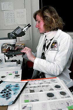 Pap smear being examined under microscope