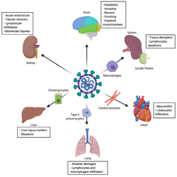 Tropism and multiple organ injuries in SARS-CoV-2 infection