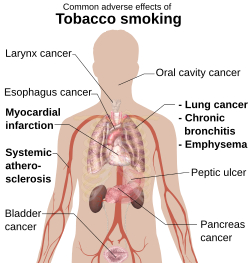 Common adverse effects of tobacco smoking