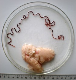 Ovary of a marine fish and its parasite, the nematode Philometra fasciati