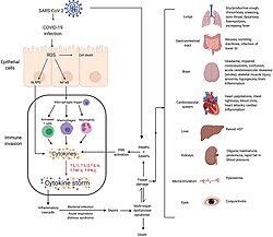 Mechanisms of SARS-CoV-2 cytokine storm and complications