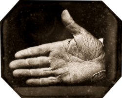 The inscription on the back of the case reads: This Daguerreotype was taken by Southworth Aug. 1845 it is a copy of Captain Jonathan Walker's hand as branded by the U.S. Marshall of the Dist. of Florida for having helped 7 men to obtain 'Life Liberty, and Happiness.' SS Slave Saviour Northern Dist. SS Slave Stealer Southern Dist.