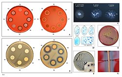 Hemolysis on blood agar, DNase activity, clumping factor, latex agglutination, growth on mannitol-salt and Baird-Parker agar, hyaluronidase production.
