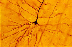 The Golgi stain first allowed for the visualization of individual neurons.