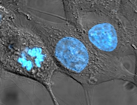 HeLa cells stained for nuclear DNA with the blue fluorescent Hoechst dye. The central and rightmost cells are in interphase, thus their entire nuclei are labeled. On the left, a cell is going through mitosis and its DNA has condensed.