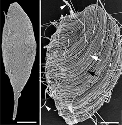 Scanning electron micrographs of a symbiontid showing two types of epibiotic bacteria: rod-shaped proteobacteria (white arrow) and spherical verrucomicrobia (black arrow) that discharge threads of DNA (white arrowheads).