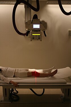 Radiography used to identify possible bone fractures after a knee injury