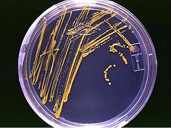 An agar plate streaked with microorganisms