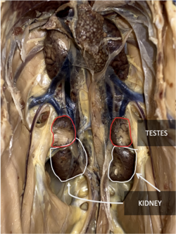 Chicken's kidneys visualized at the bottom of the abdomen cavity, along the medial spine of the chicken. Testes are labeled above the kidneys.