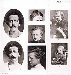 Illustration of grief from Charles Darwin's 1872 book The Expression of the Emotions in Man and Animals