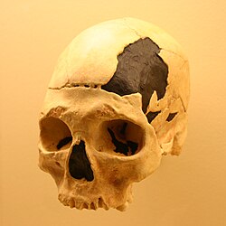 Oase 2 skull may be a human-Neanderthal hybrid.