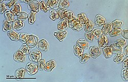 Pollen grains viewed through a high-powered microscope.
