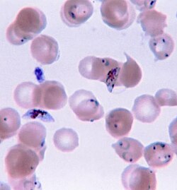 The eukaryotic parasite Plasmodium falciparum (spiky blue shapes), a causative agent of malaria, in human blood