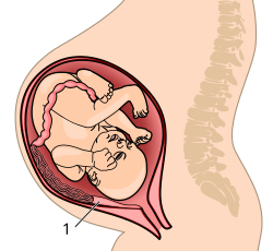 The placenta attaches to the uterine wall, and the umbilical cord connects it to the fetus.