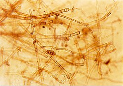 Septate hyphae of the fungus Alternaria, showing the septa between individual cells