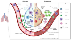 Mild versus severe immune response during virus infection
